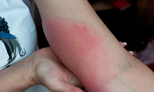 get rid of wasp nest