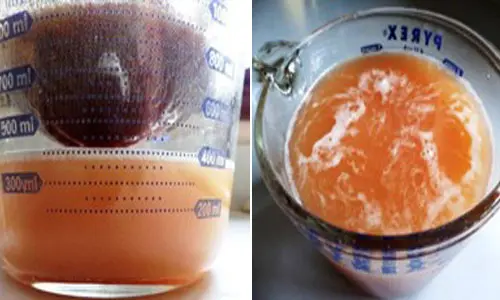 DIY Apple Cider Vinegar