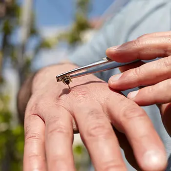 Lemon + Baking Soda - bee stings