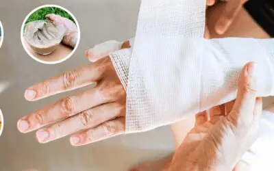 How to Manage Serious Wounds With Household Items