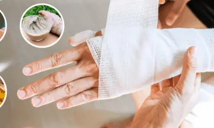 How to Manage Serious Wounds With Household Items