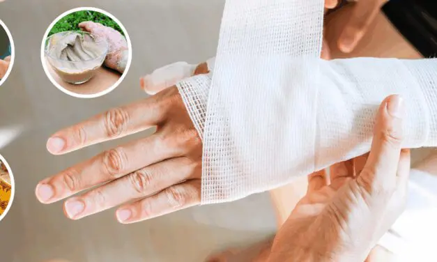 How to Manage Serious Wounds With Household Items