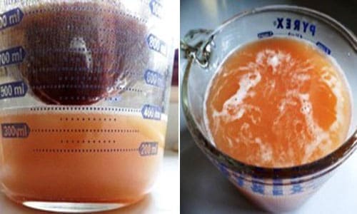 DIY Apple Cider Vinegar