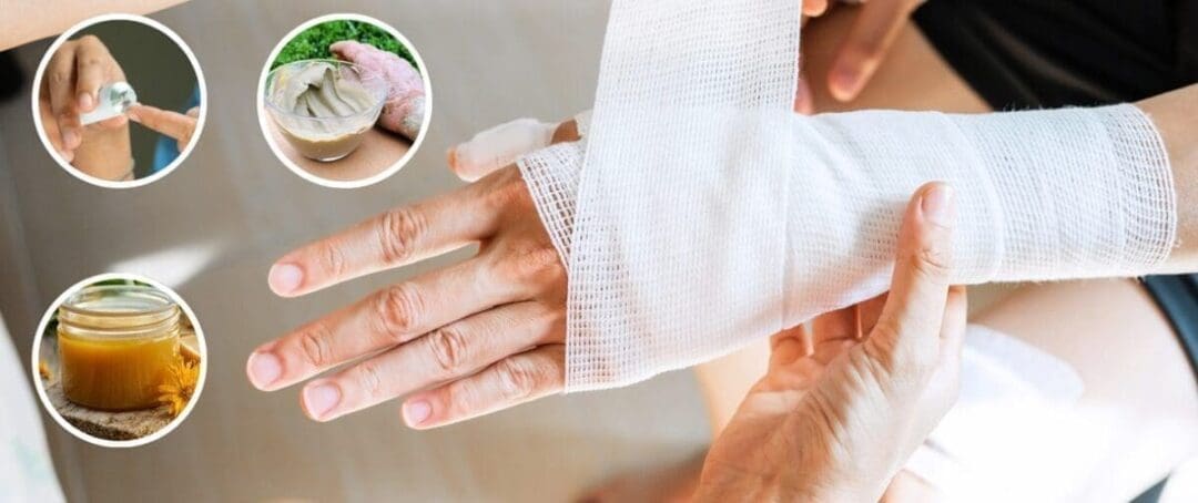 How to Manage Serious Wounds With Household Items