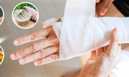 How to Manage Serious Wounds With Household Items