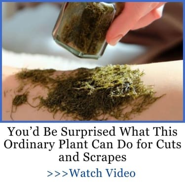 You’d Be Surprised What This Ordinary Plant Can Do for Cuts and Scrapes TLRA