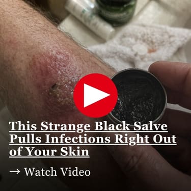 This Strange Black Salve Pulls Infections Right Out of Your Skin Close-up of a red, inflamed skin sore on a lower leg next to a hand holding an open tin of dark ointment in a bathroom setting.